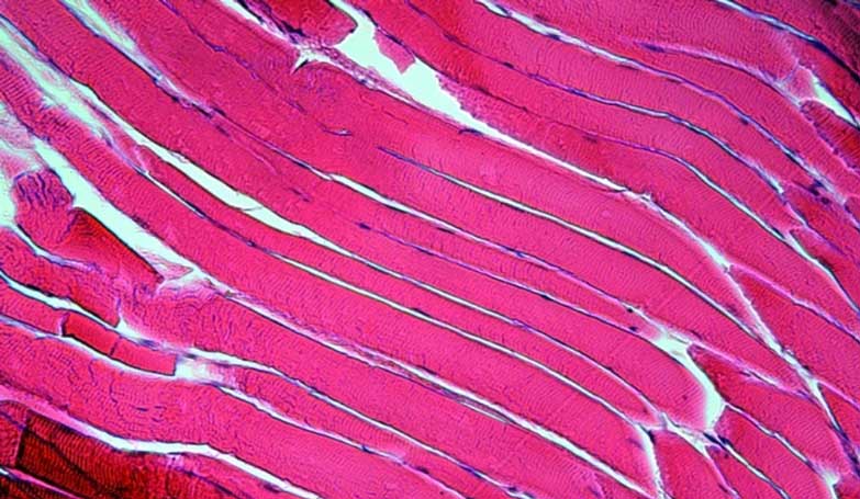 Enhancing NAD+ Can Restore Age-Related Muscle Degeneration in Human Cells
