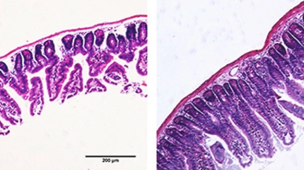 Study Finds NMN Protects Intestinal Wall from Cancer Radiation Therapy Injury