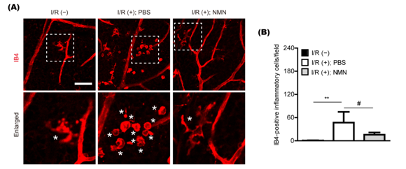 NMN prevents the buildup of inflammatory cells in the retina