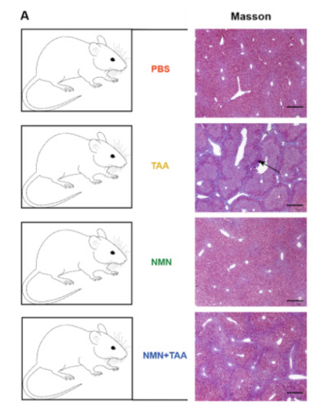 NMN prevented liver fibrosis in mice treated with thioacetamide
