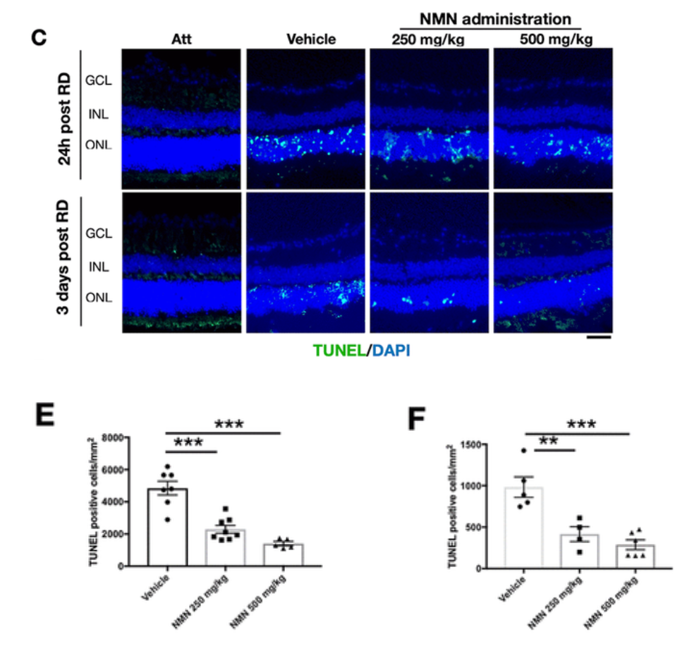 Administering mice with NMN significantly reduced photoreceptor cell death after retinal detachment