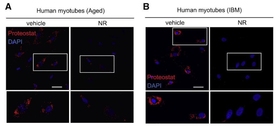 Boosting NAD+ levels reduces amyloid-like deposits in human muscle cells