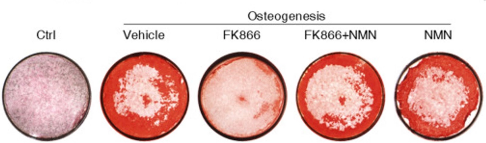 NMN is required for adult stem cells to generate bone.