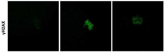 NMN reduces DNA damage in obese female mice