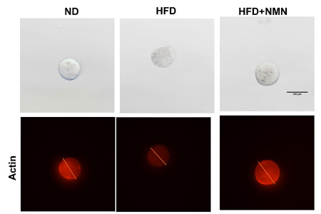 NMN restores actin structural protein abundance