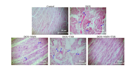 NMN and troxerutin treatment protects heart tissue against doxorubicin treatment