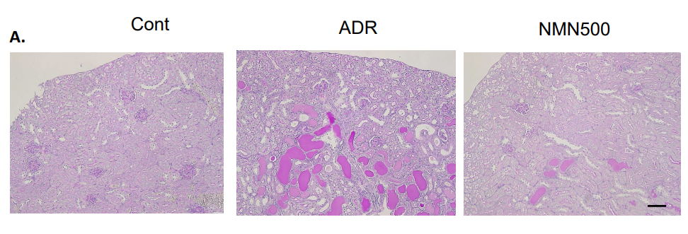 NMN reduces kidney tissue damage.