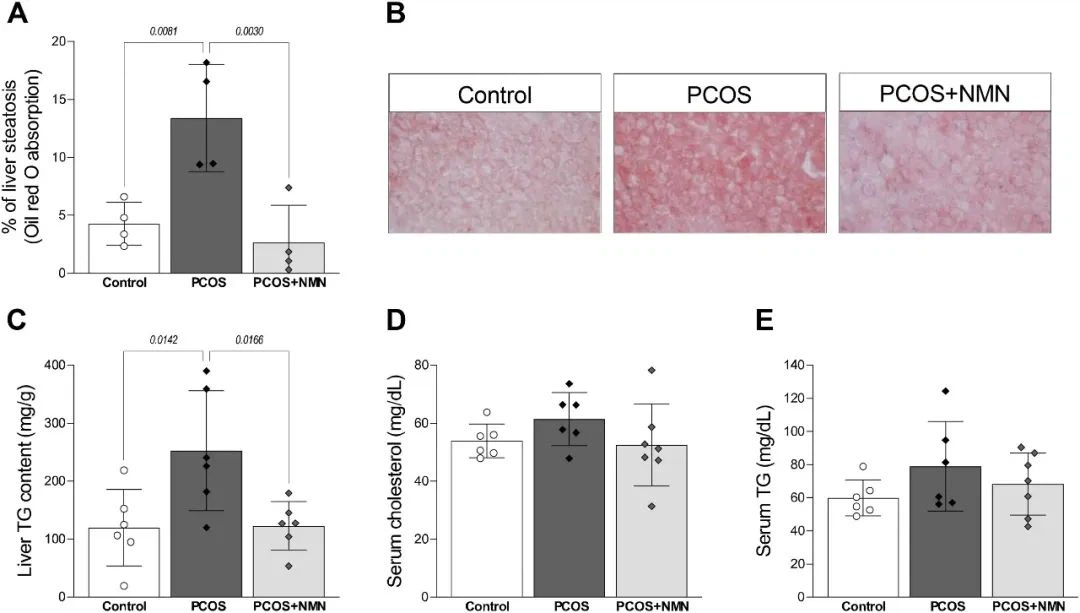 NMN restores hepatic steatosis