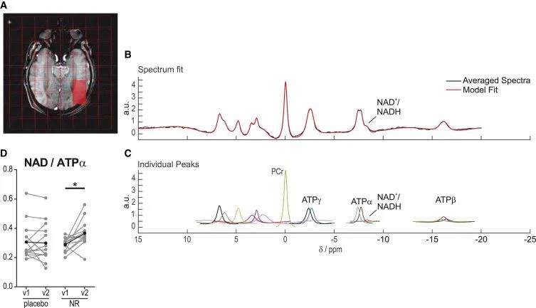 NMN Is Expected To Treat PD