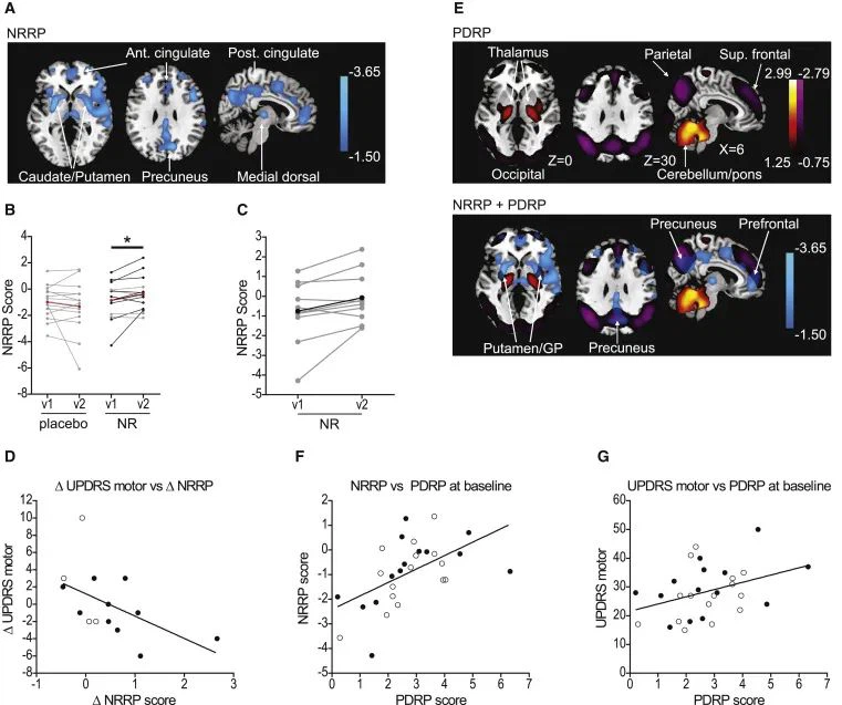 NMN Is Expected To Treat PD