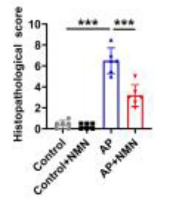 NMN May Relieve Acute Pancreatitis