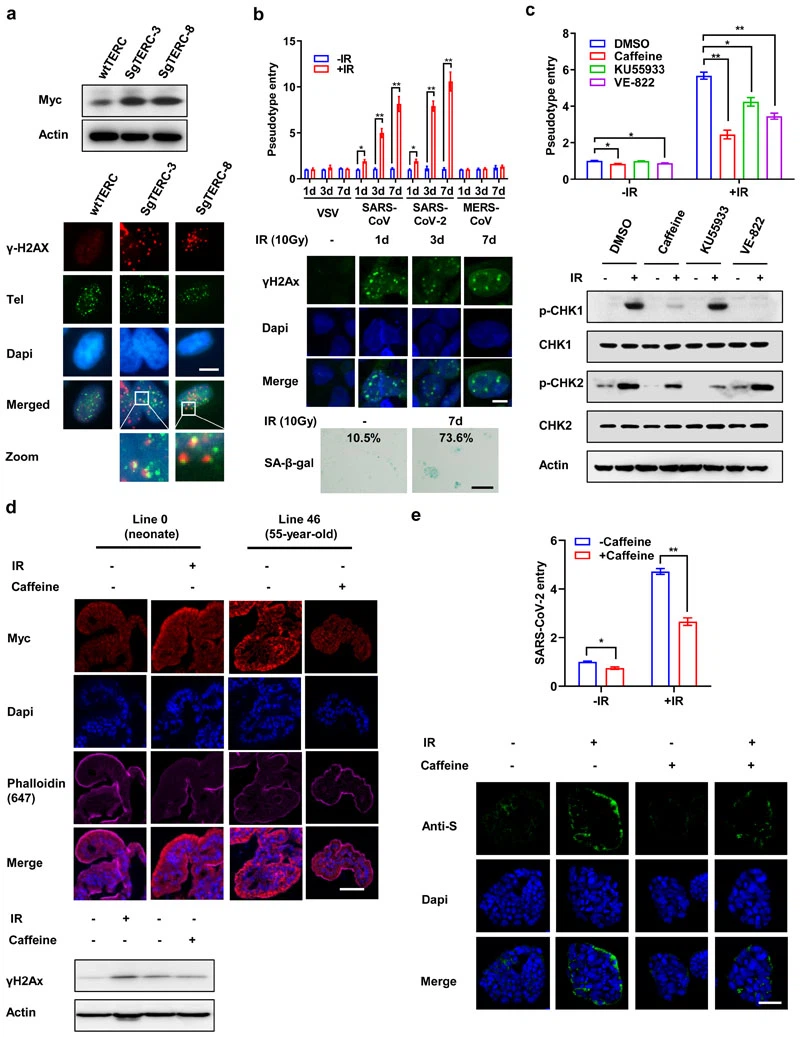 NMN May Mitigate COVID-19 Infection And Lung Injury