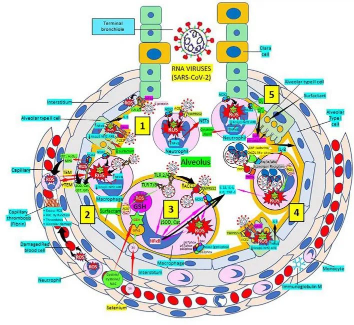 Boosting GSH could be effective therapy against COVID-19
