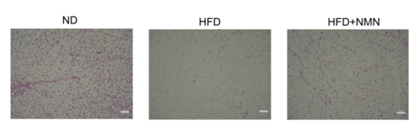 Histological examination showed that adipocytes in subcutaneous adipose tissue were reduced by NMN treatment Histological examination showed that adipocytes in subcutaneous adipose tissue were reduced by NMN treatment