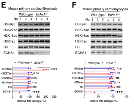 Echs1 deficiency causes cardiac fibrosis in mice Echs1 deficiency causes cardiac fibrosis in mice
