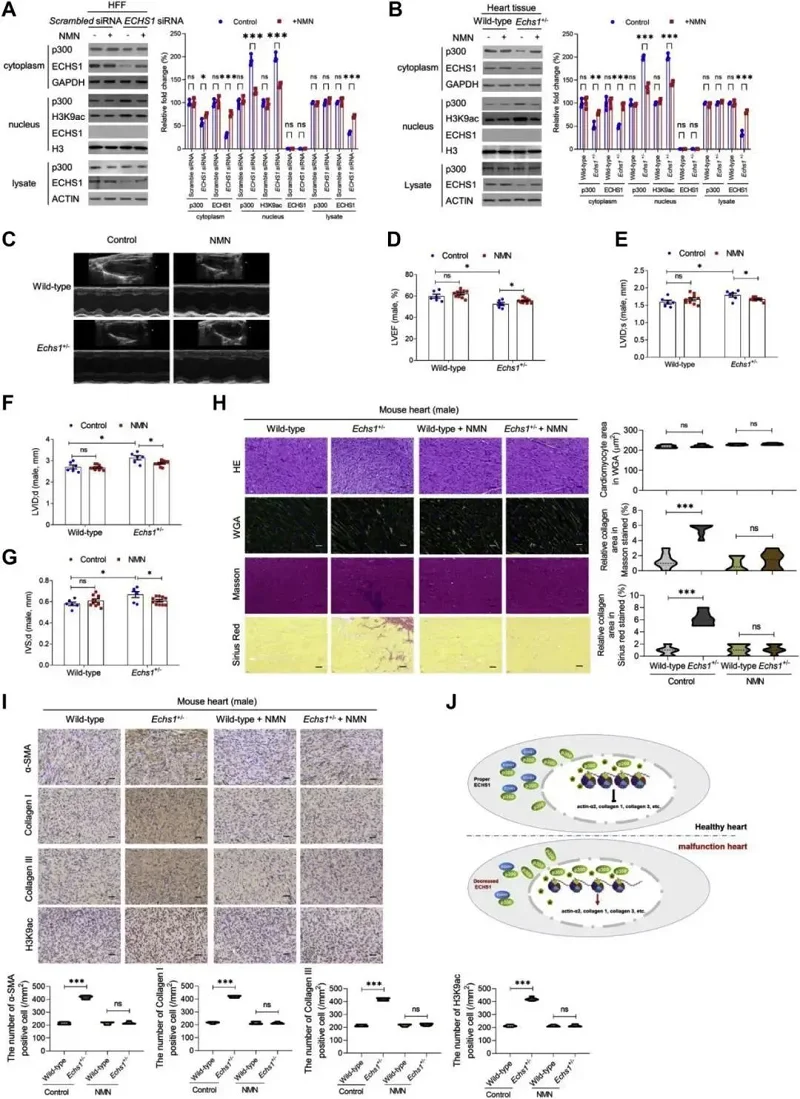 NMN effectively prevents the development of cardiomyopathy in Echs1 gene-deficient animals NMN effectively prevents the development of cardiomyopathy in Echs1 gene-deficient animals