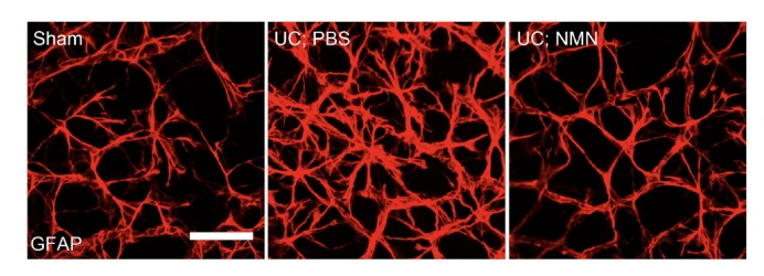 Note: NMN may prevent the activation of glial cells