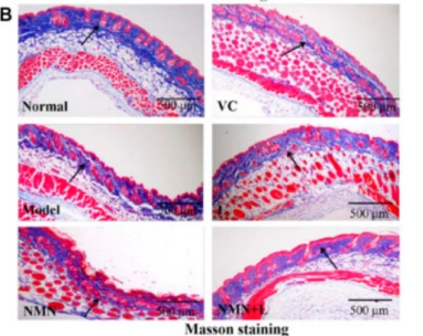 The results of TB staining were shown in the figure