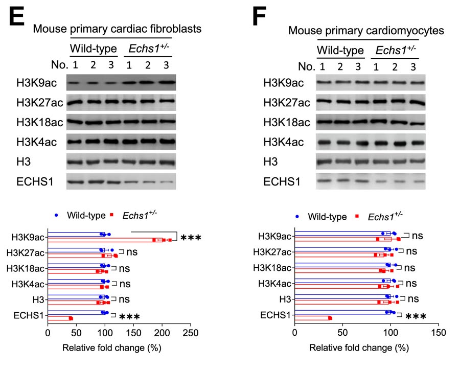 Echs1 is a key enzyme in the oxidation of fatty acids and branched-chain amino acids, and its deficiency leads to cardiac fibrosis in mice. Echs1 is a key enzyme in the oxidation of fatty acids and branched-chain amino acids, and its deficiency leads to cardiac fibrosis in mice.