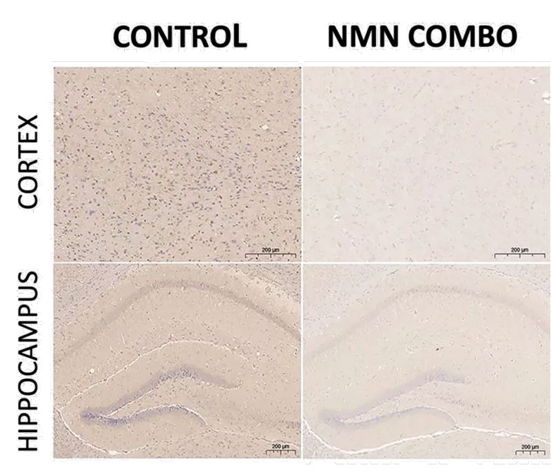 The combination of NMN, L. plantaurum and lactulose reduces Alzheimer's disease plaques. Patches are indicated by purple spots. The NMN combination had fewer purple spots than the control group, indicating fewer Aβ plaques. The combination of NMN, L. plantaurum and lactulose reduces Alzheimer's disease plaques. Patches are indicated by purple spots. The NMN combination had fewer purple spots than the control group, indicating fewer Aβ plaques.