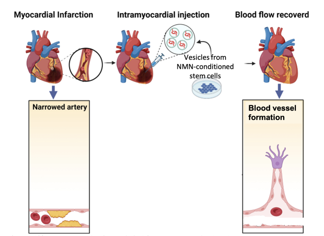 NMN Assists Stem Cell Exosomes: Bringing New Hope for Heart Repair