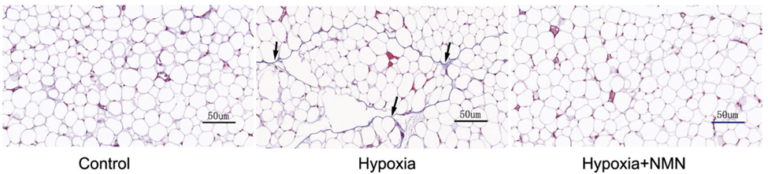 NMN attenuates adipose tissue fibrosis under hypoxic conditions