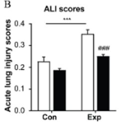 NMN prevents acute lung injury (ALI) in PM-exposed mice.