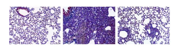 From left to right: normal, silica-injured, and NMN-treated silica-injured lung tissue stained for scarring (purple)