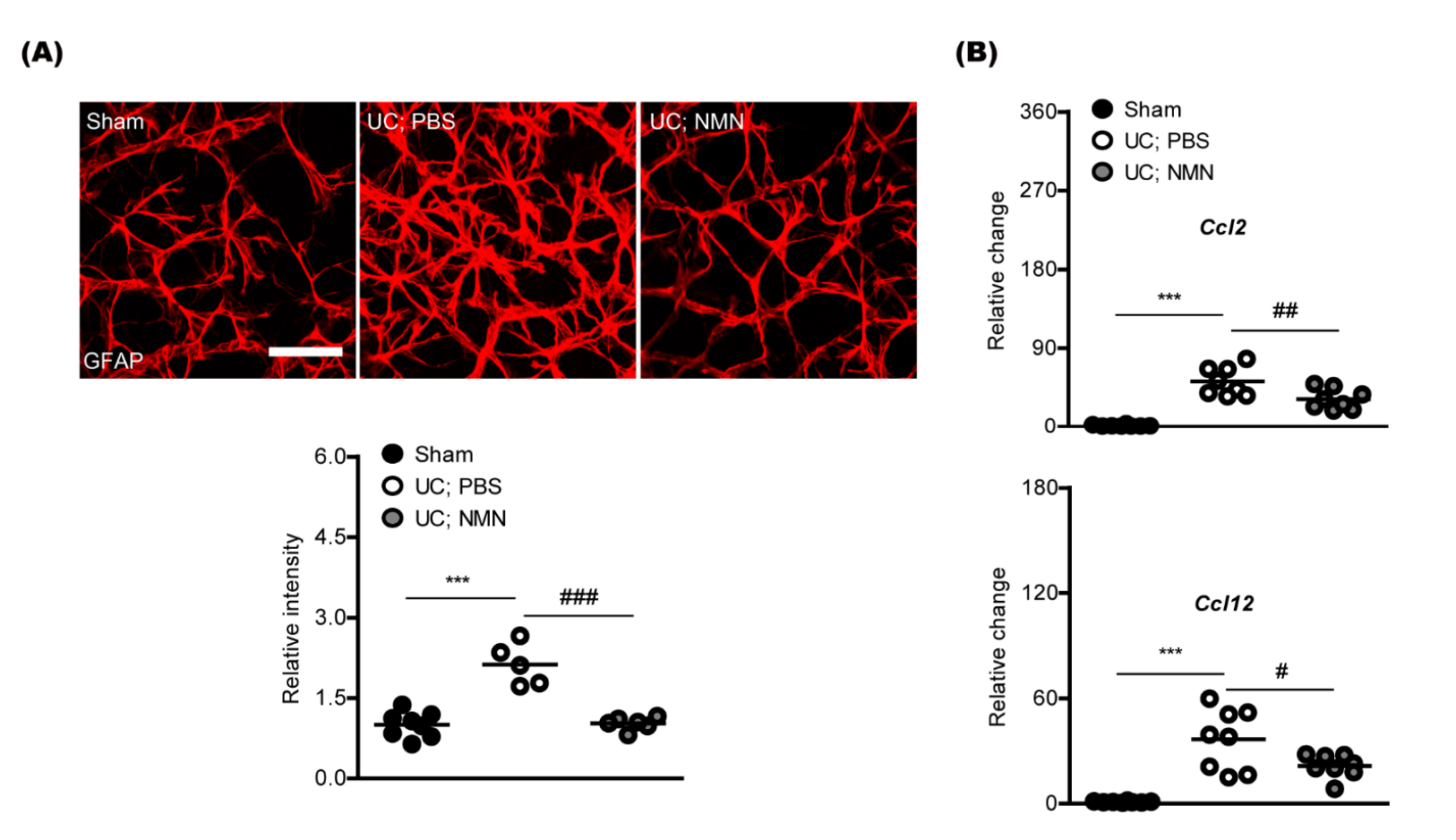 Figure: NMN improves retinal gliosis and inflammation