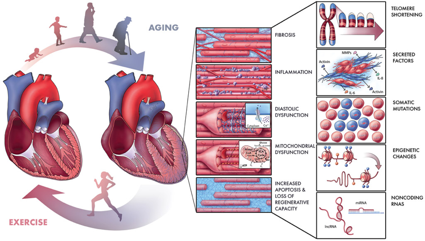 Figure: Heart disease processes associated with aging
