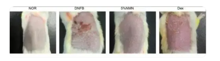 NMN can prevent skin damage caused by inflammation