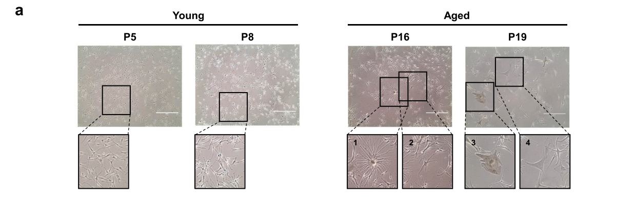 Comparison of morphology of young and aged melanocytes