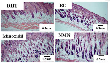 NMN improves hair growth and promotes hair follicle growth