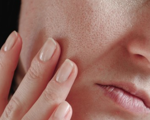 NMN has emerged as a potential solution for skin aging