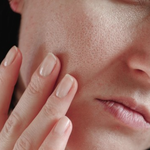 NMN has emerged as a potential solution for skin aging
