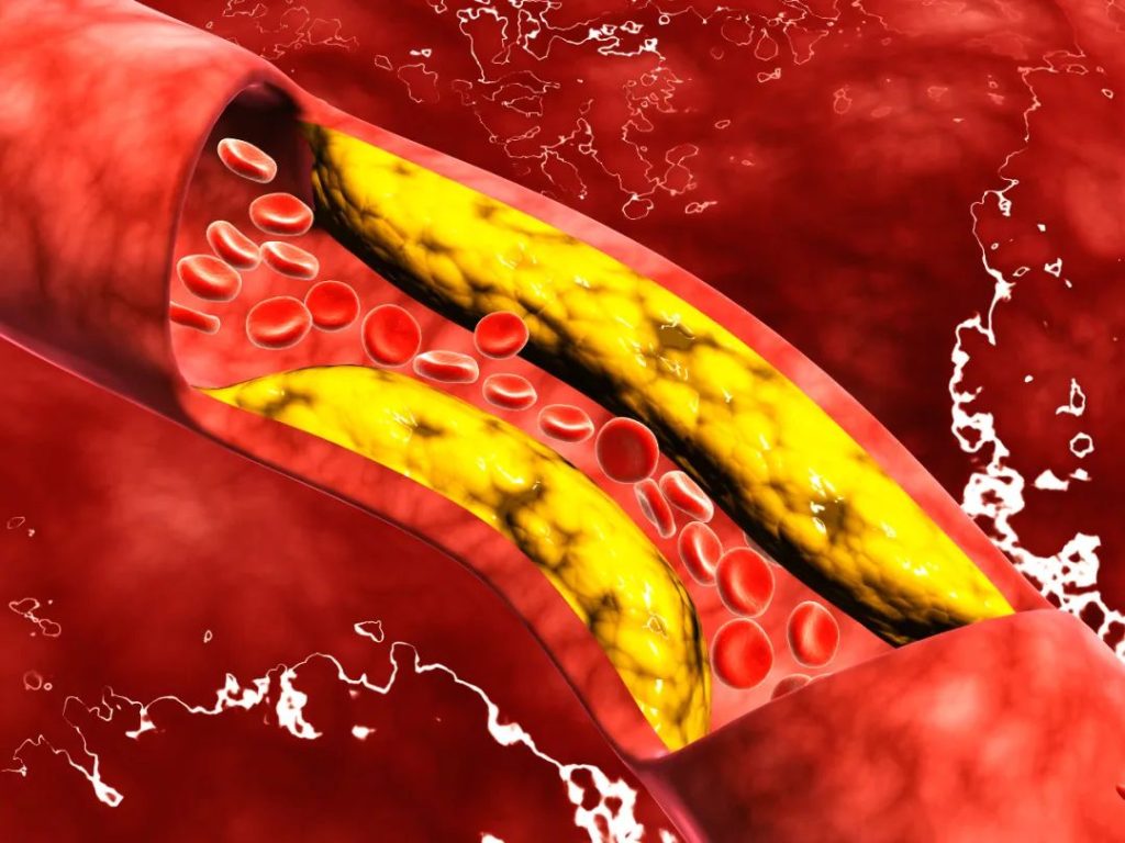 3.NMN can prevent and improve cardiovascular and cerebrovascular diseases