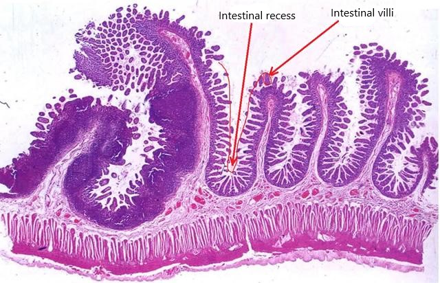 Figure 4 Intestinal recesses and villi