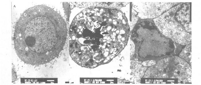 A 10-ingredient anti-aging supplement acts directly on cells 12 Detection of curcumin-induced apoptosis of HT-29 cells by transmission electron microscopy (×4000)