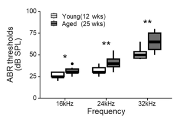 A recent study in Japan found that NMN can inhibit hearing loss 2 Compared to young mice (white), older mice (gray) require higher sound intensity to stimulate electrical activity at multiple frequencies in the brain (ABR threshold), which indicates hearing loss.