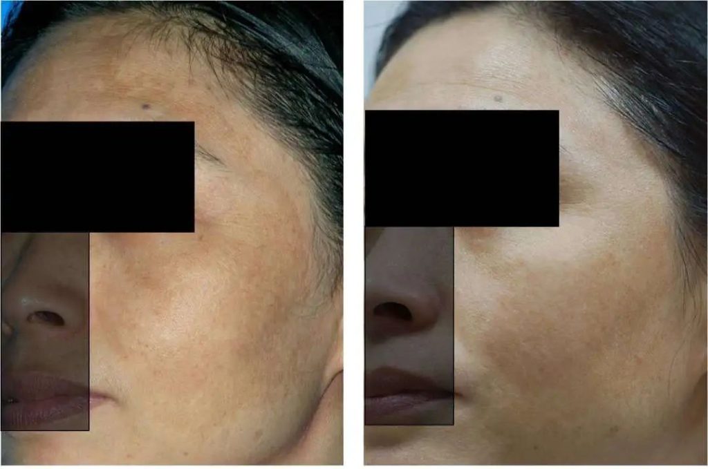 Can save liver damage glutathione, can anti-aging whitening really? 12 Can save liver damage glutathione, can anti-aging whitening really?