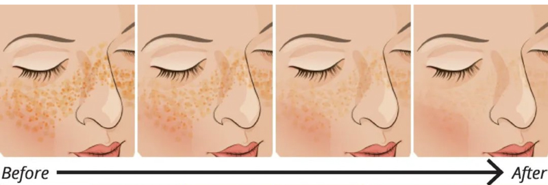 Can save liver damage glutathione, can anti-aging whitening really? 10 Can save liver damage glutathione, can anti-aging whitening really?