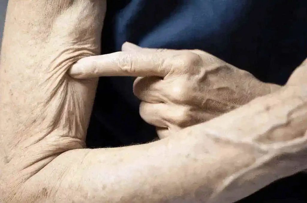 After NMN is converted into NAD+, it is also beneficial to bone health